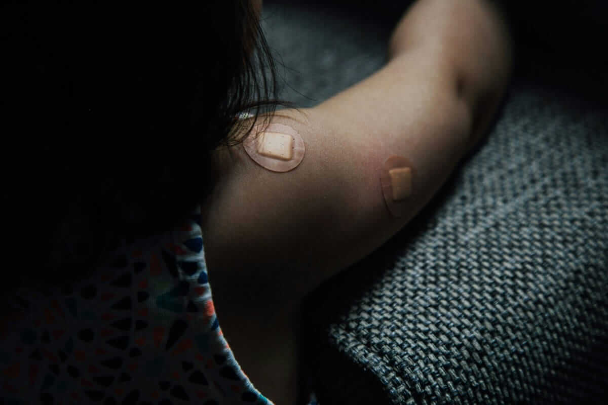 Meningokokken, Impfung / Kleinkind-Arm mit zwei Pflastern nach einer Impfung beim Kinderarzt