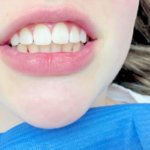 Zahnprophylaxe bei Kindern